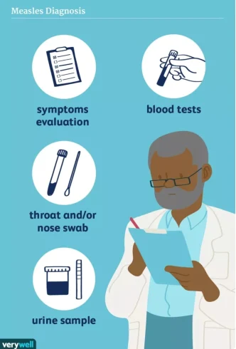 سرخک چگونه تشخیص داده می‌شود؟