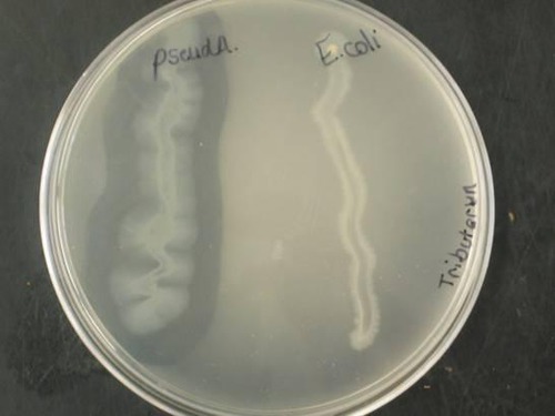 تست لیپاز (Lipase)