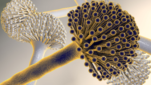 بیماری-قارچی آسپرژیلوس