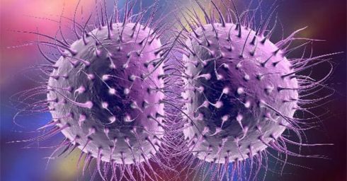 آزمایش اورتریت غیر گونوکوکی ngu