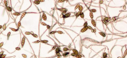 آلترناریا آلترناتا Alternaria alternata