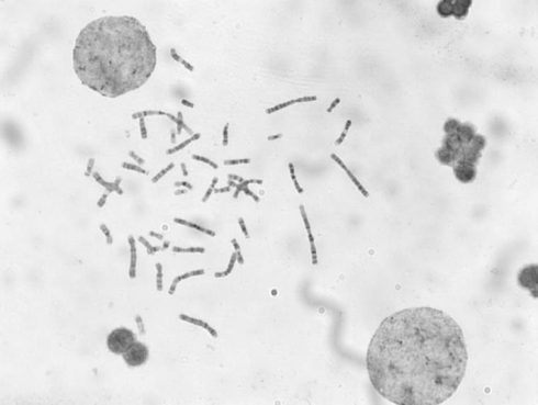 درسنامه دوره سیتوژنتیک و کاریوتایپ