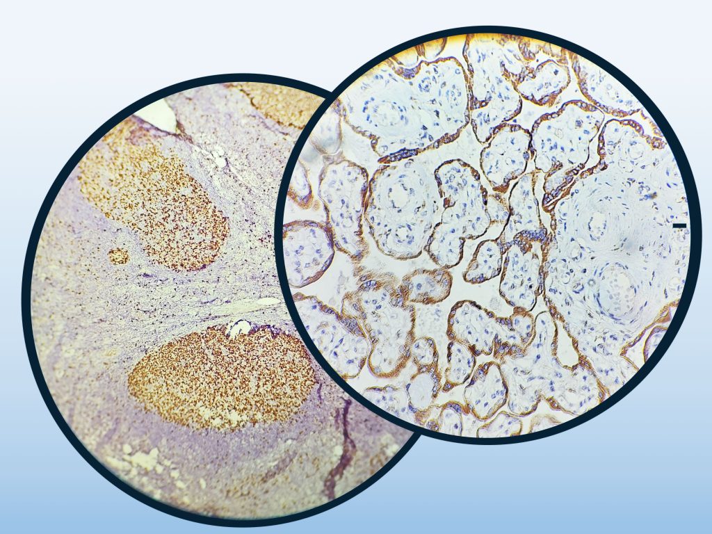 خدمات پاتولوژی -IHC