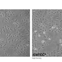 Alternative view of رده سلولی Du-145