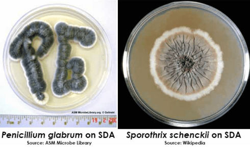 مورفولوژی کلنی در SDA