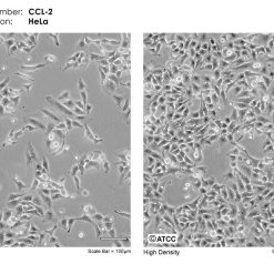 فروش رده سلولی hela