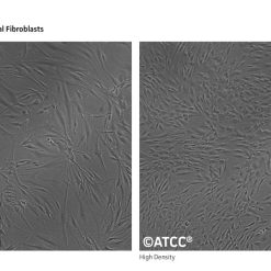 Alternative view of رده سلولی HGF-1
