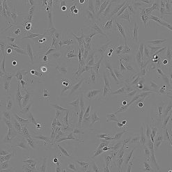 Alternative view of رده سلولی MG-63