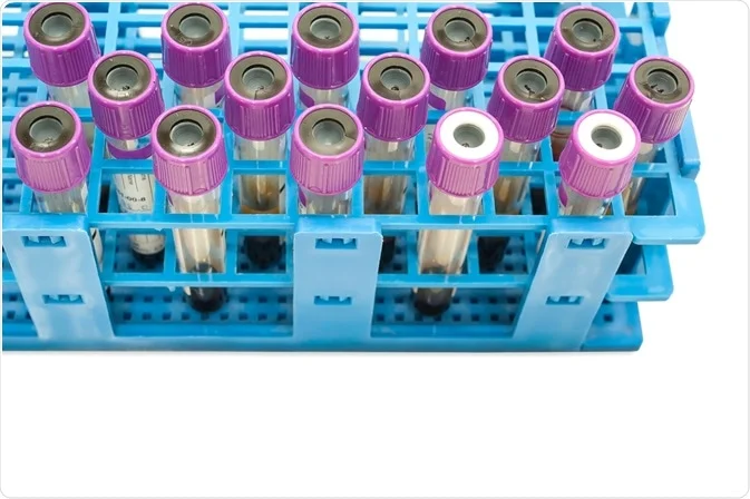 استفاده از فلوسایتومتری برای تشخیص PIDs