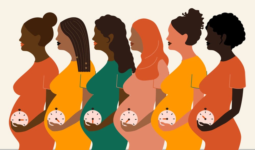 زایمان زودرس