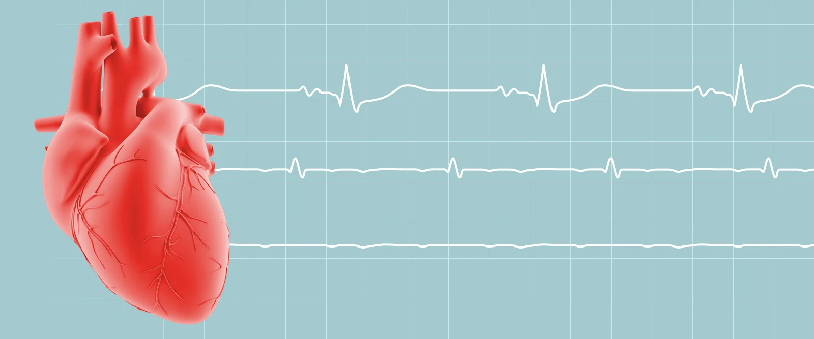 نارسایی قلبی