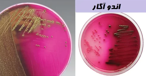 اندو آگار (Endo Agar): ترکیب، اصول، روش آماده‌سازی و کاربرد