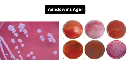 اشدون آگار (Ashdown’s Agar): ترکیب، اصول، آماده‌سازی، نتایج و کاربرد