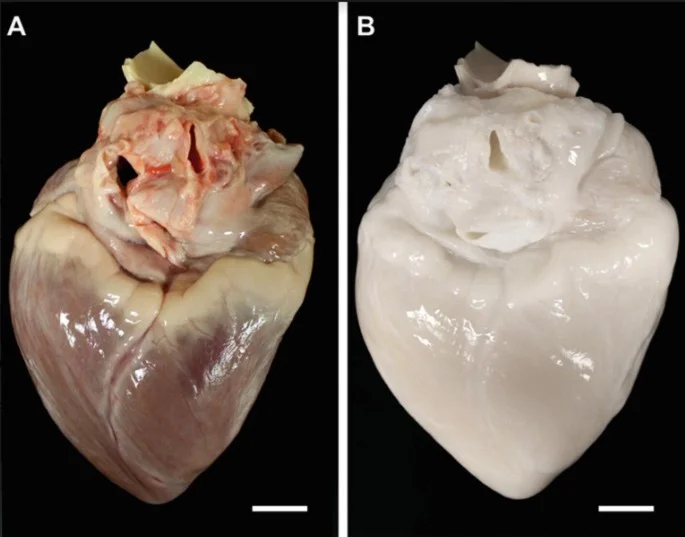 Tissue Decellularization
