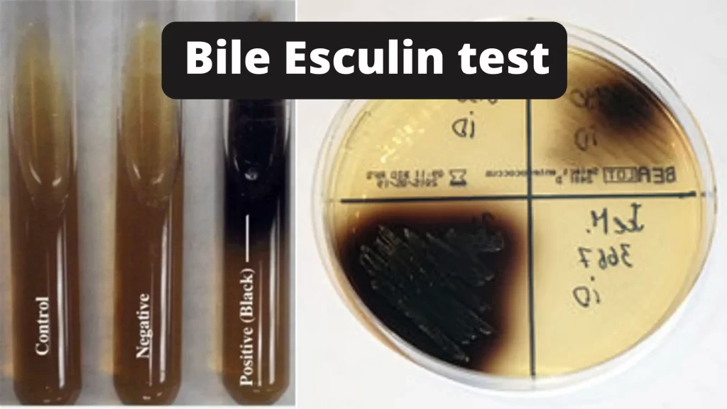 تست بایل اسکولین (Bile Esculin Test): اصول، روش، کاربرد و تفسیر