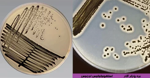 برد پارکر آگار