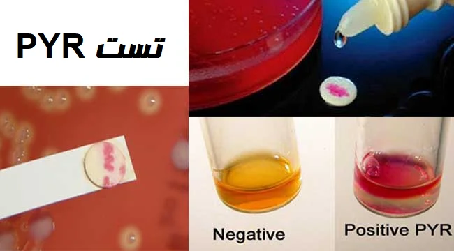تست pyr