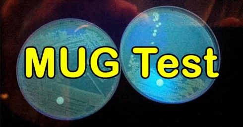 تفسیر نتایج تست mug