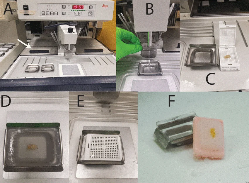 پارافینه و امبدینگ کست