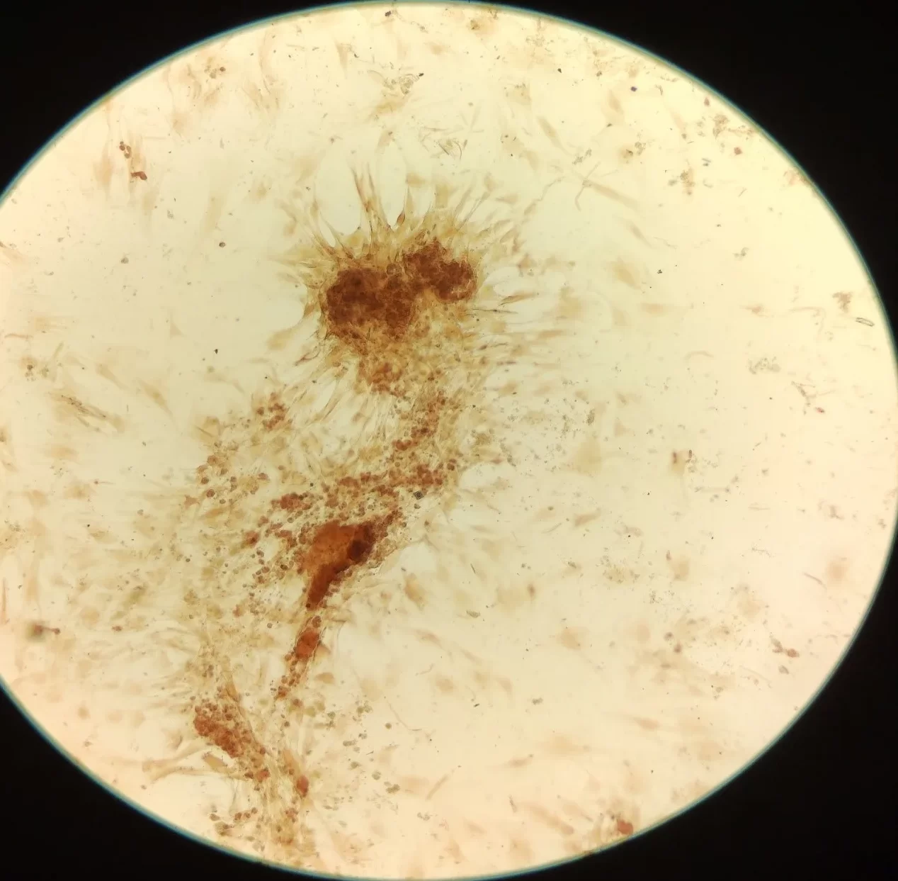 رنگ آمیزی سلول با آلیزارین رد