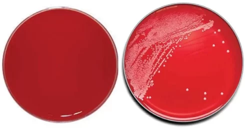 محیط کشت هارت اینفیوژن آگار