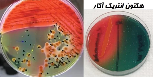 هکتون انتریک آگار
