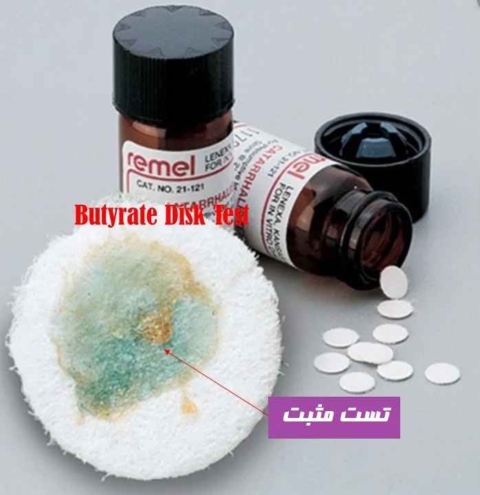 آزمایش دیسک بوتیرات