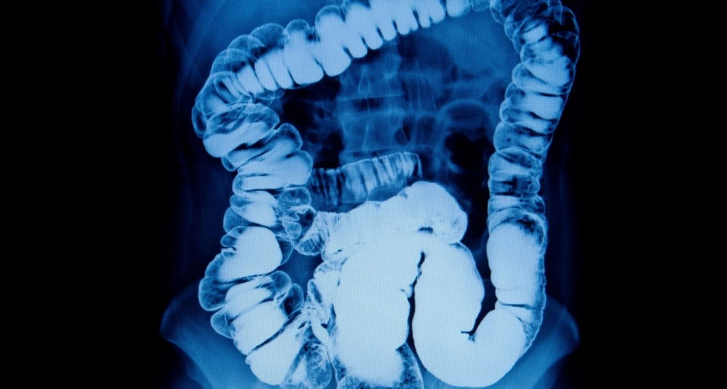 اشعه ایکس باریم