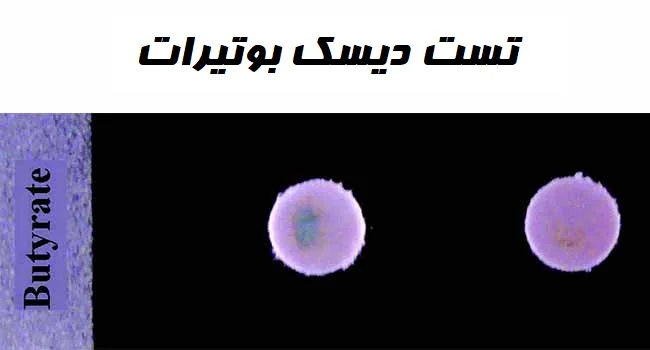 تست دیسک بوتیرات