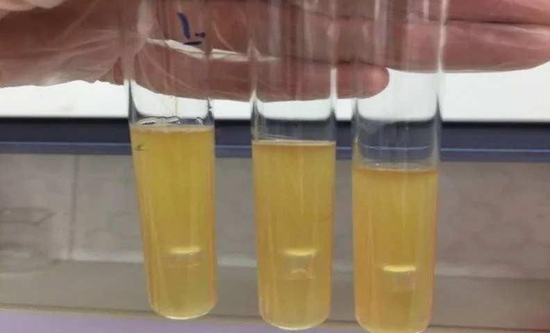 تشخیص باکتری کلیفرم