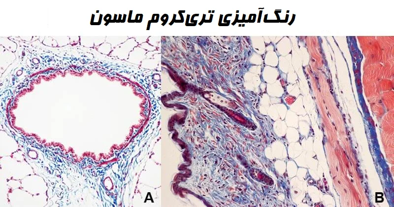 رنگ آمیزی تریکروم ماسون چیست