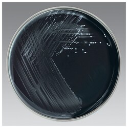 روش تهیه محیط کشت انتخابی زغال چوب