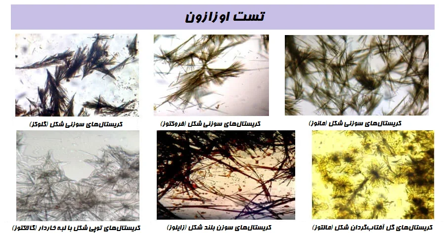 تست اوزازون (Osazone Test)