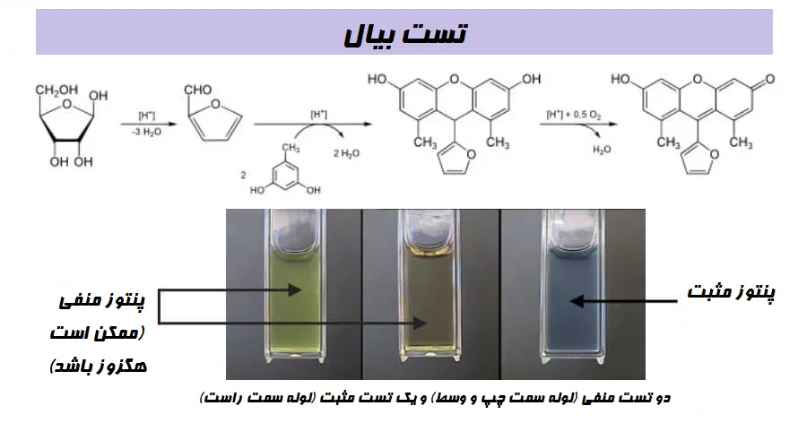 تست بیال
