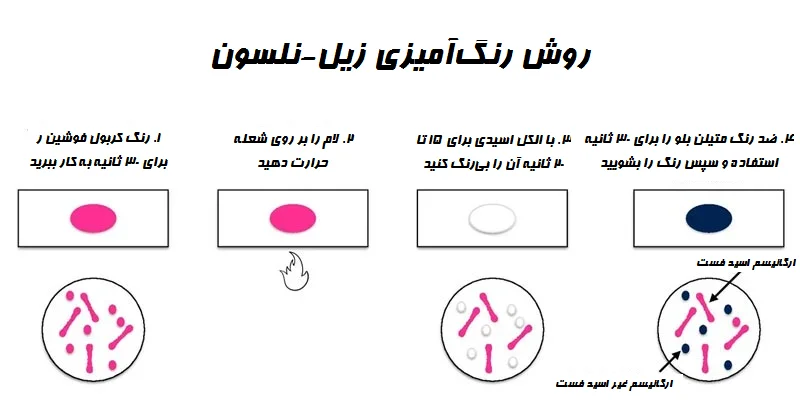 رنگ آمیزی زیل-نلسون (Ziehl-Neelsen Staining): اصول و روش با نتایج