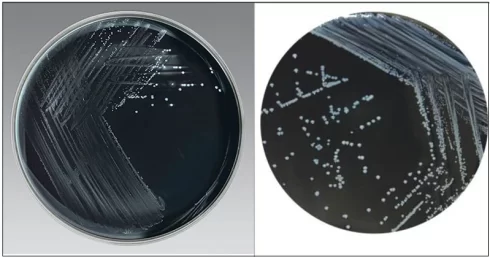 محیط کشت انتخابی زغال چوب