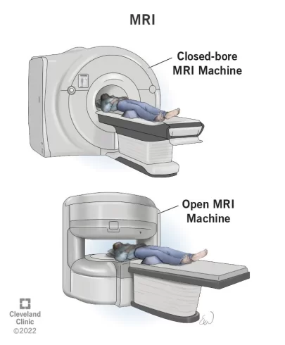 دستگاه mri