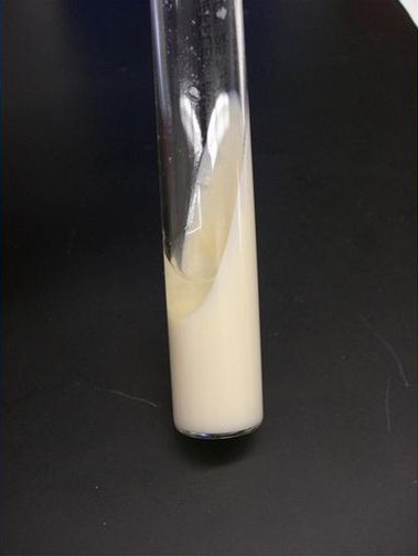 نتایج محیط کشت لوفلر