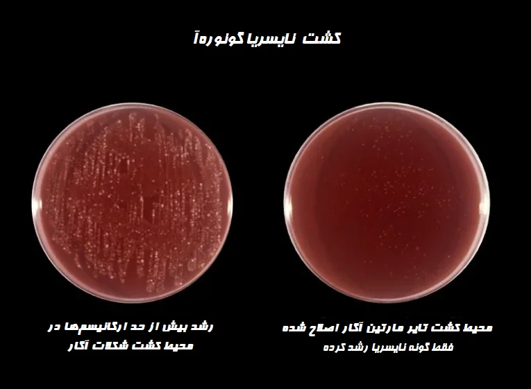 تفسیر نتیجه تایر مارتین آگار اصلاح شده