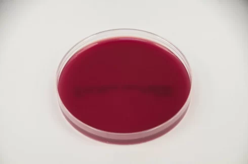 بلاد آگار بی‌هوازی