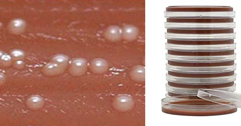 تایر مارتین آگار اصلاح شده