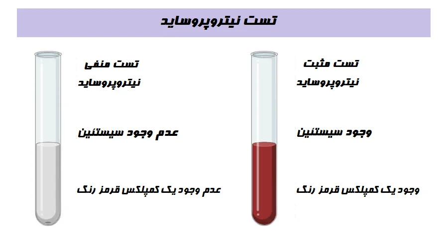 تست نیتروپروساید