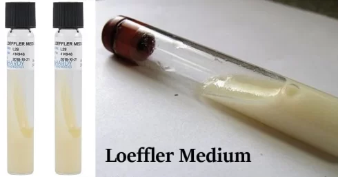 محیط کشت لوفلر