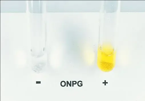 تست onpg چیست؟