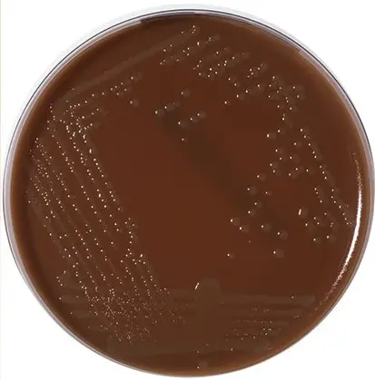 محیط کشت لوینتال چیست