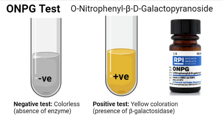 اصول تست onpg