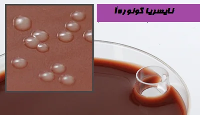 نتایج مارتین لوئیس آگار