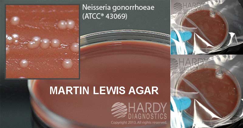 ترکیبات مارتین لوئیس آگار