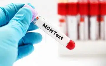 تست mch خون