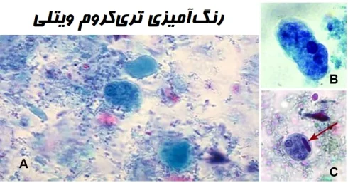 نتایج و تفسیر رنگ آمیزی تریکروم ویتلی